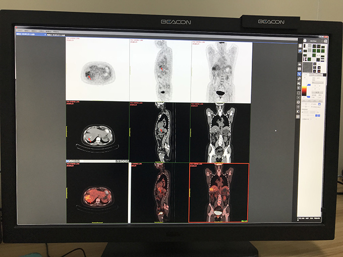 厉害了！高端医学影像诊断设备飞利浦64排128层PET/CT落户如皋广慈医院，市民健康再添保障！